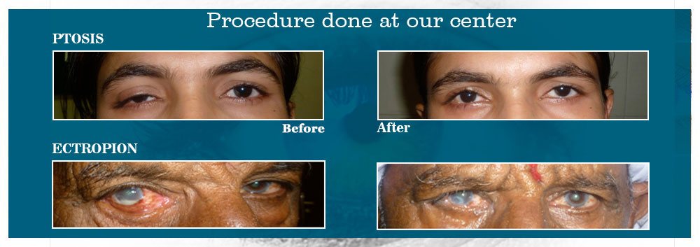 Eye Hospital In Ahmedabad, Best Oculoplastic Surgeon in Ahmedabad, Navkar Hospital Ahmedabad, Navkar Hospital Shreyas Crossing Ahmedabad