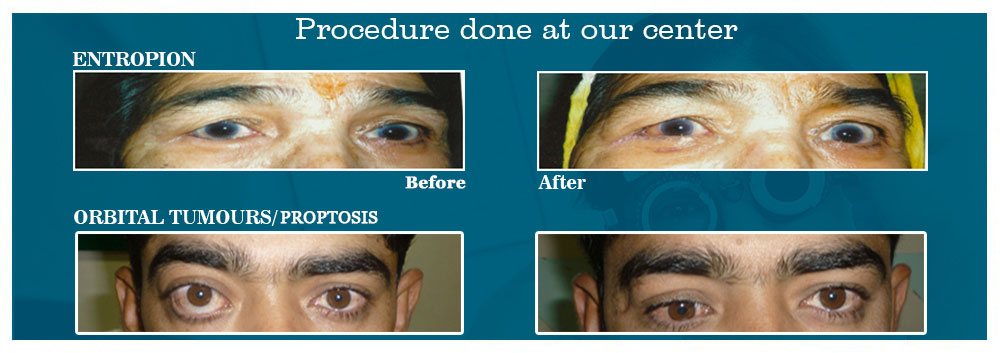 Eye Surgery In Ahmedabad, Best Ophthalmologist in Ahmedabad, Eye Specialist Doctor in Ahmedabad, Top 10 Eye Specialist in Ahmedabad