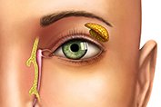 Lacrimal Treatment in Ahmedabad