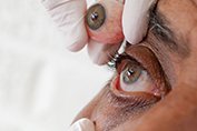 Prosthesis Eye in Ahmedabad