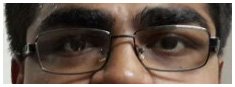 Ophthalmologist Surgery in Ahmedabad, Laser Eye Surgery Cost in Ahmedabad, Eye Hospital in Ahmedabad List.